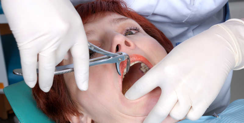 正在接受牙医拔牙手术的女人