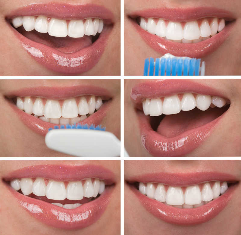 刷牙的女人牙齿拼贴