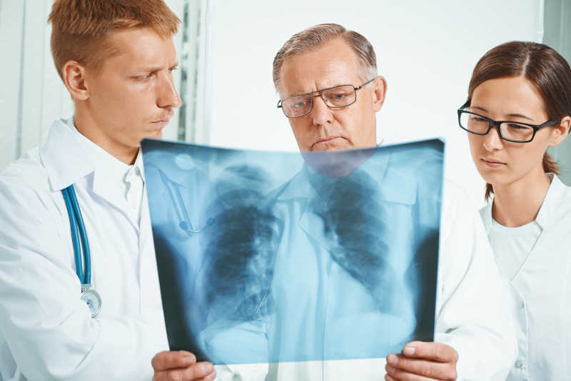 医生们在检查肺部的X光影像