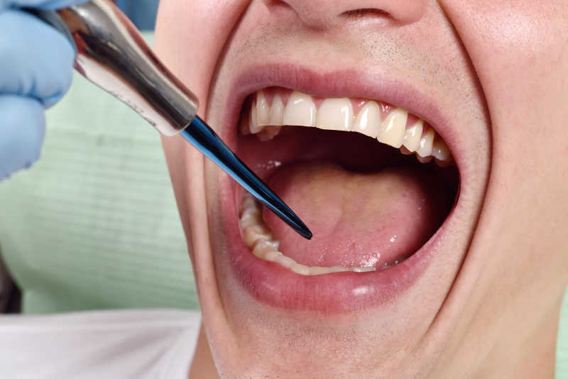 牙科医生检查病人的牙齿