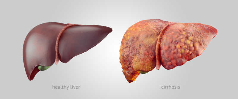 肝脏对比