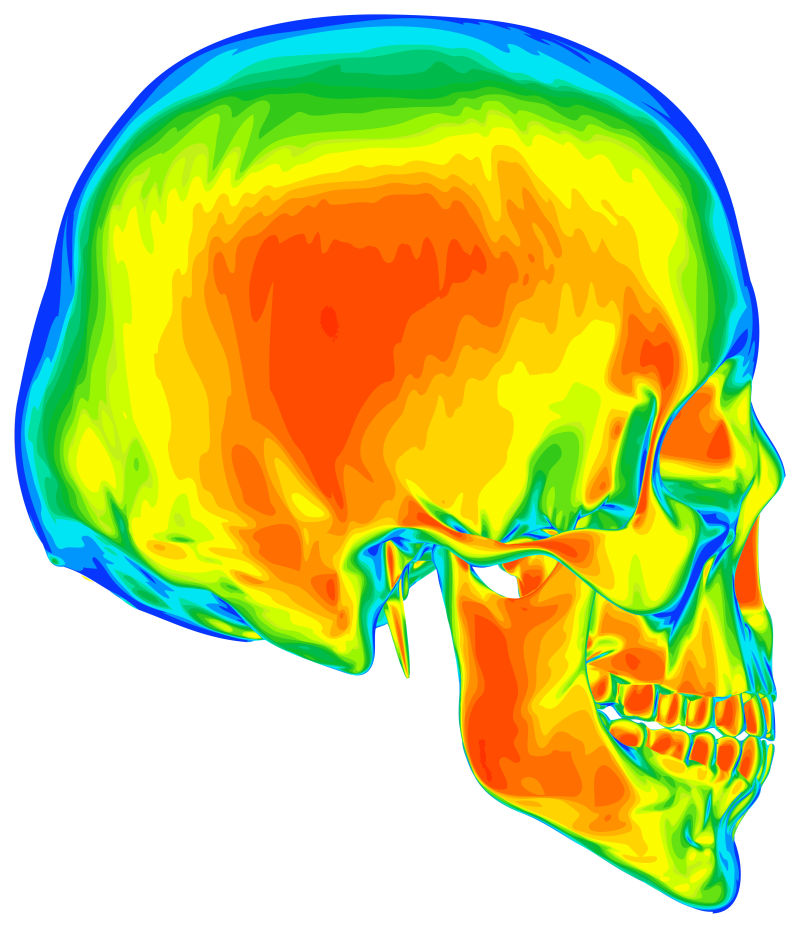 人类颅骨的热图像矢量插图