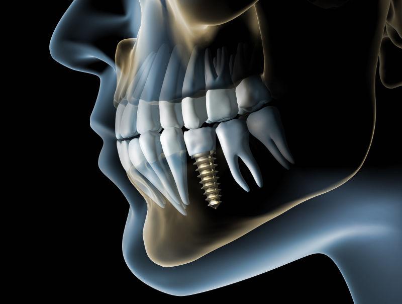 牙齿的健康检查概念