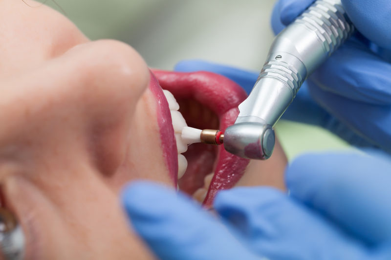 牙医用工具清洗病人的牙齿