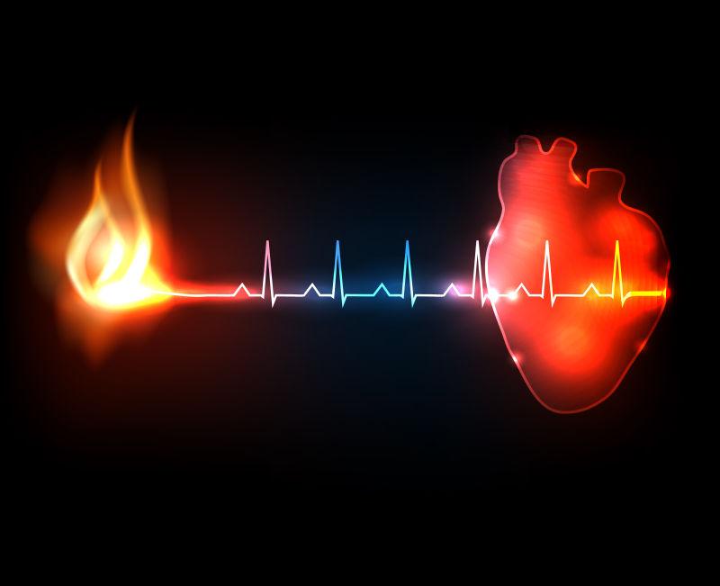 燃烧心电图概念性心脏病