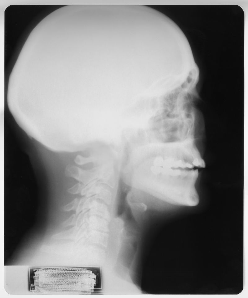 人体颈部颈椎宣传册设计矢量图
