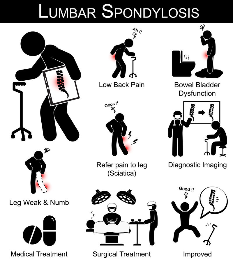 腰椎病症状象形图（腰痛，指腿部疼痛、腿部麻木无力、肠膀胱功能障碍）和医疗、外科治疗