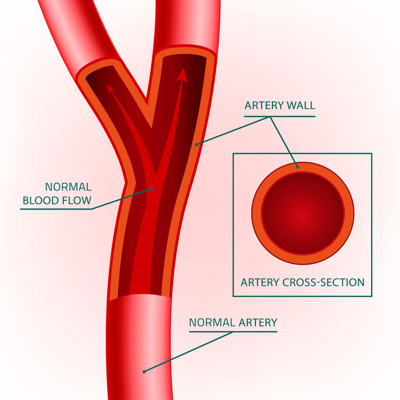 血管图像