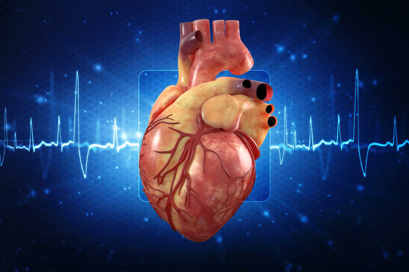 人的心脏——人体心脏解剖学