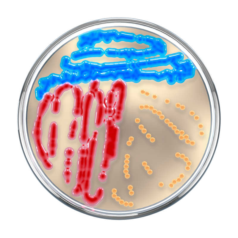 培养皿上彩色细菌